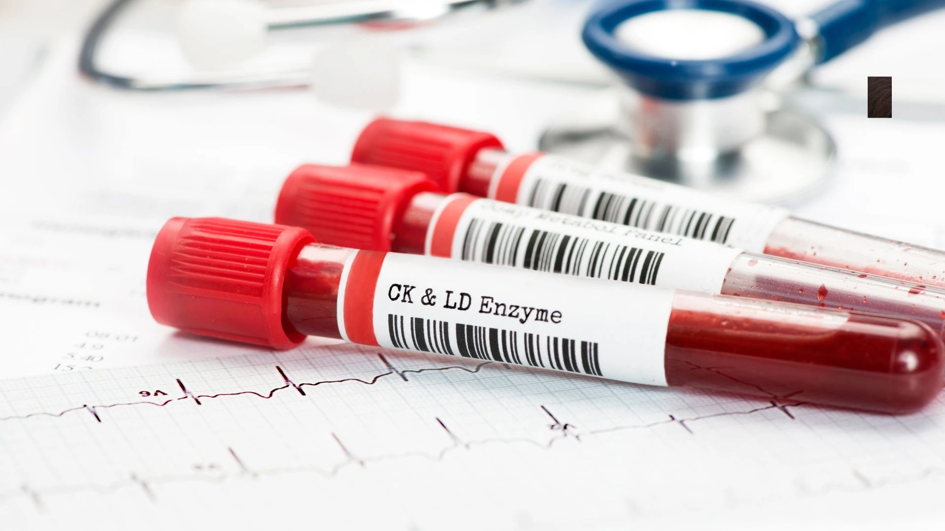 Blood Tests