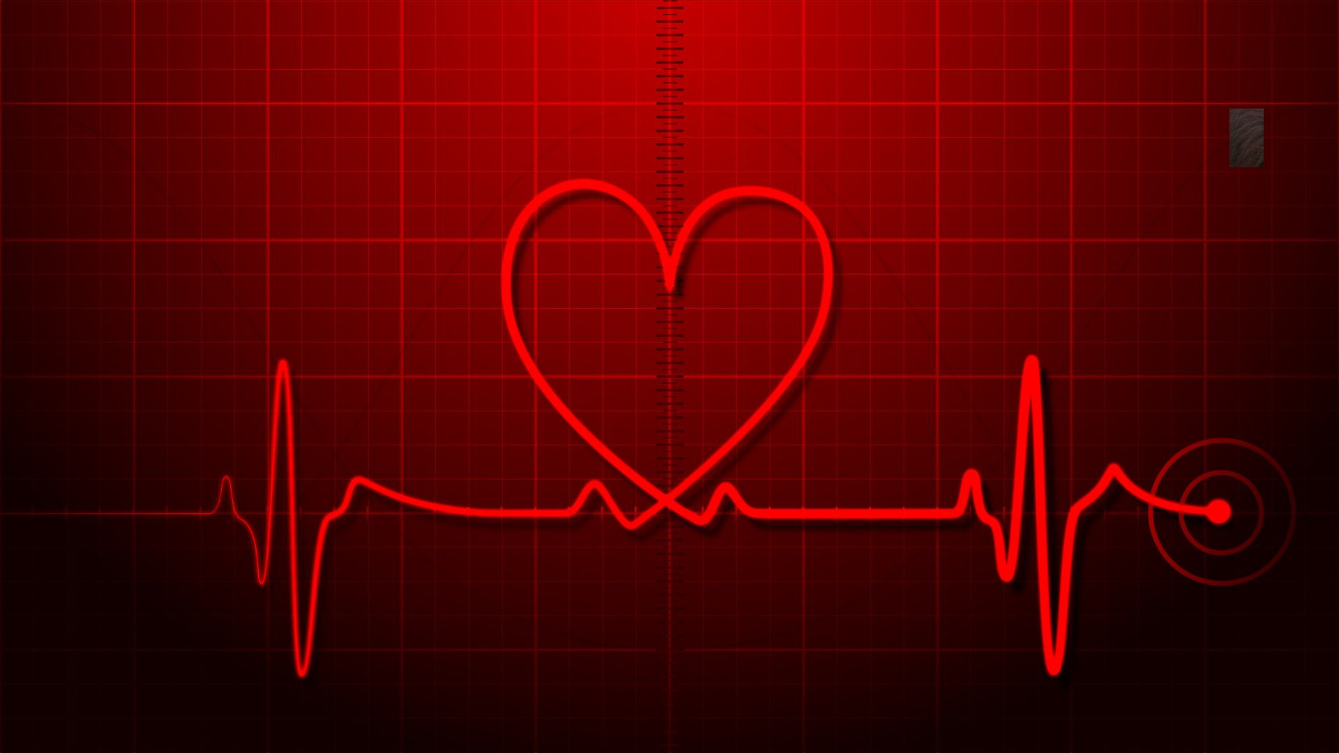 Electrocardiogram