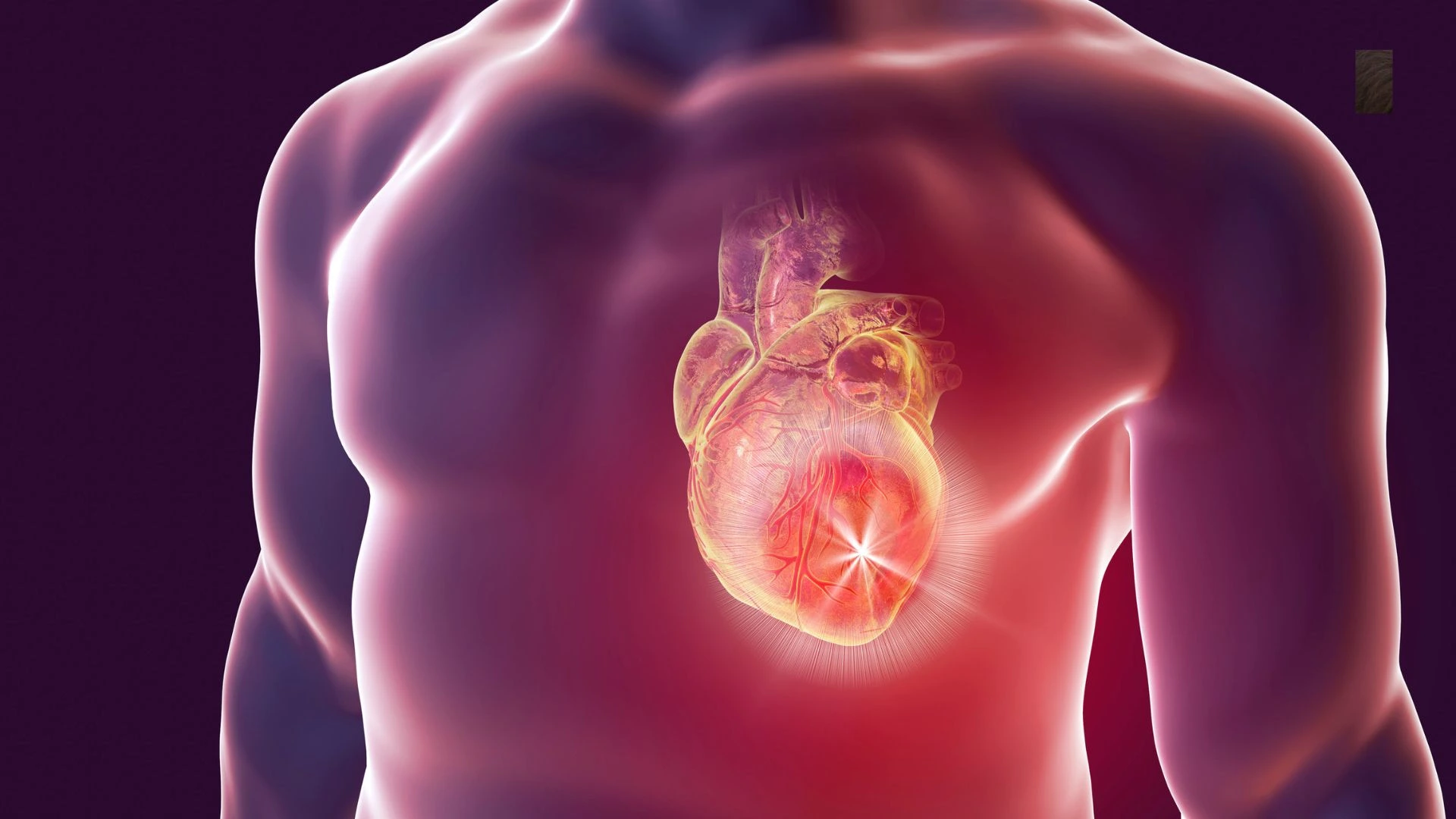 Transient Ischaemic Attack